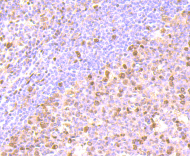 Paraformaldehyde-fixed and paraffin-embedded Human Tonsil tissue incubated with FKBP5 (6G6) Monoclonal Antibody (bsm-54309R) at 1:100, overnight at 4°C, followed by a conjugated secondary antibody and DAB staining. Counterstained with hematoxylin.