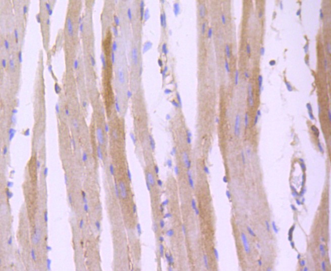 Paraformaldehyde-fixed and paraffin-embedded Mouse heart tissue incubated with ROCK1 (3A1) Monoclonal Antibody (bsm-52470R) at 1:100, overnight at 4\u00b0C, followed by a conjugated secondary antibody and DAB staining. Counterstained with hematoxylin.