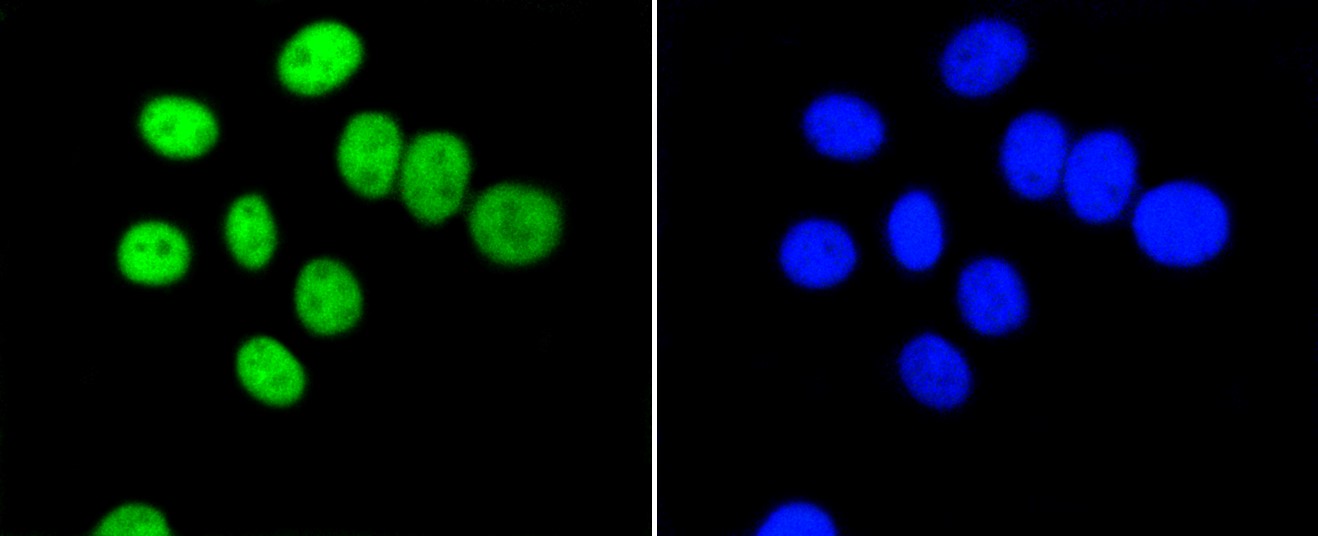 IF(ICC) staining with PIM1 (5A12) Monoclonal Antibody (bsm-52472R) at 1:100 in BT-20 cells (green). The nuclear counterstain is DAPI (blue). Cells were fixed in paraformaldehyde, permeabilized with 0.25% Triton X100/PBS.