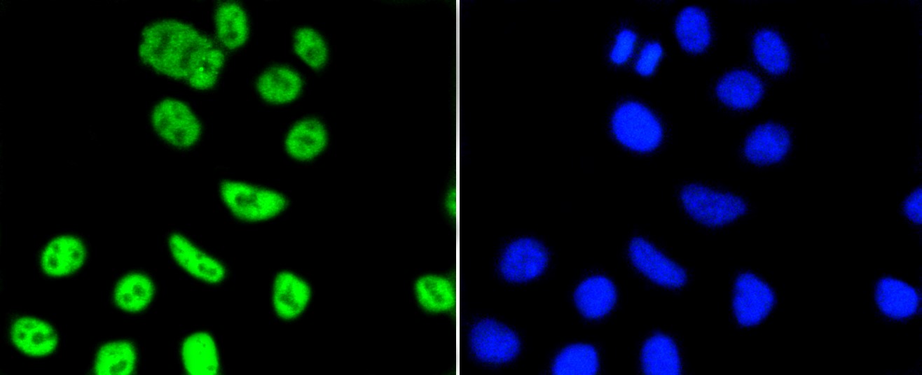 IF(ICC) staining with PIM1 (5A12) Monoclonal Antibody (bsm-52472R) at 1:100 in HepG2 cells (green). The nuclear counterstain is DAPI (blue). Cells were fixed in paraformaldehyde, permeabilized with 0.25% Triton X100/PBS.