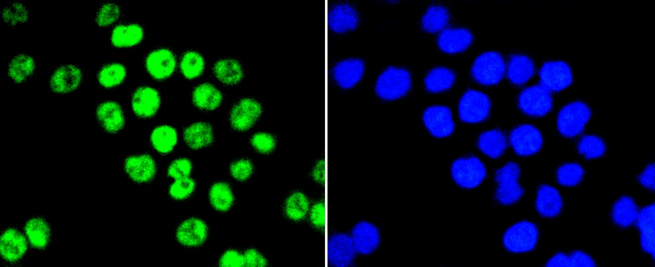 IF(ICC) staining with PIM1 (5A12) Monoclonal Antibody (bsm-52472R) at 1:100 in SW480 cells (green). The nuclear counterstain is DAPI (blue). Cells were fixed in paraformaldehyde, permeabilized with 0.25% Triton X100/PBS.