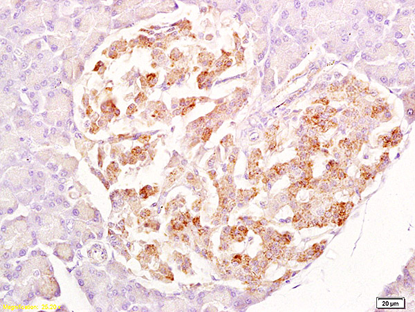Formalin-fixed and paraffin embedded rat pancreas labeled with Anti-SRG4 Polyclonal Antibody, Unconjugated (bs-1220R) at 1:200 followed by conjugation to the secondary antibody and DAB staining. Formalin-fixed and paraffin embedded rat pancreas labeled with Anti-SRG4 Polyclonal Antibody, Unconjugated (bs-1220R) at 1:200 followed by conjugation to the secondary antibody and DAB staining.