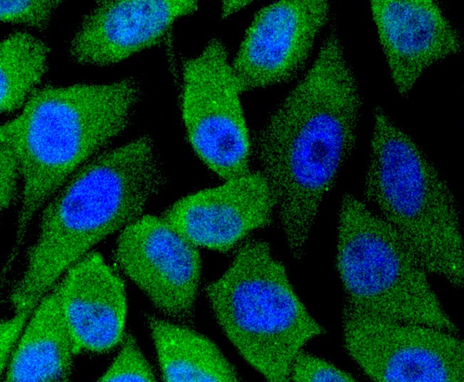 IF(ICC) staining with nNOS (14G6) Monoclonal Antibody (bsm-52474R) at 1:100 in PC-3M cells (green). The nuclear counterstain is DAPI (blue). Cells were fixed in paraformaldehyde, permeabilized with 0.25% Triton X100/PBS.