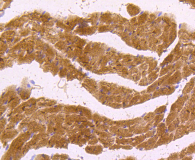 Paraformaldehyde-fixed and paraffin-embedded Mouse heart tissue incubated with nNOS (14G6) Monoclonal Antibody (bsm-52474R) at 1:100, overnight at 4°C, followed by a conjugated secondary antibody and DAB staining. Counterstained with hematoxylin.