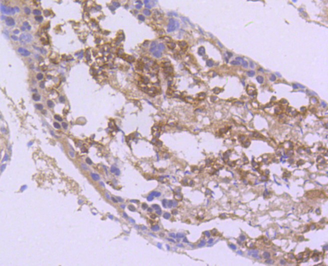 Paraformaldehyde-fixed and paraffin-embedded Rat testis tissue incubated with nNOS (14G6) Monoclonal Antibody (bsm-52474R) at 1:100, overnight at 4°C, followed by a conjugated secondary antibody and DAB staining. Counterstained with hematoxylin.