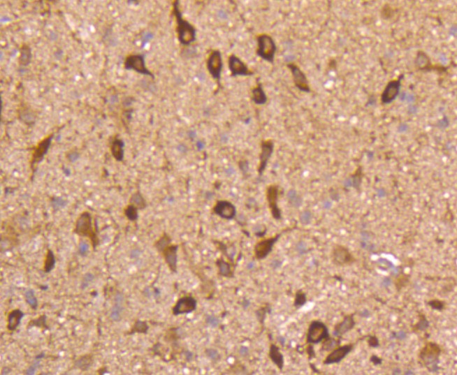 Paraformaldehyde-fixed and paraffin-embedded Rat brain tissue incubated with nNOS (14G6) Monoclonal Antibody (bsm-52474R) at 1:100, overnight at 4°C, followed by a conjugated secondary antibody and DAB staining. Counterstained with hematoxylin.