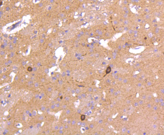 Paraformaldehyde-fixed and paraffin-embedded Mouse brain tissue incubated with nNOS (14G6) Monoclonal Antibody (bsm-52474R) at 1:100, overnight at 4°C, followed by a conjugated secondary antibody and DAB staining. Counterstained with hematoxylin.