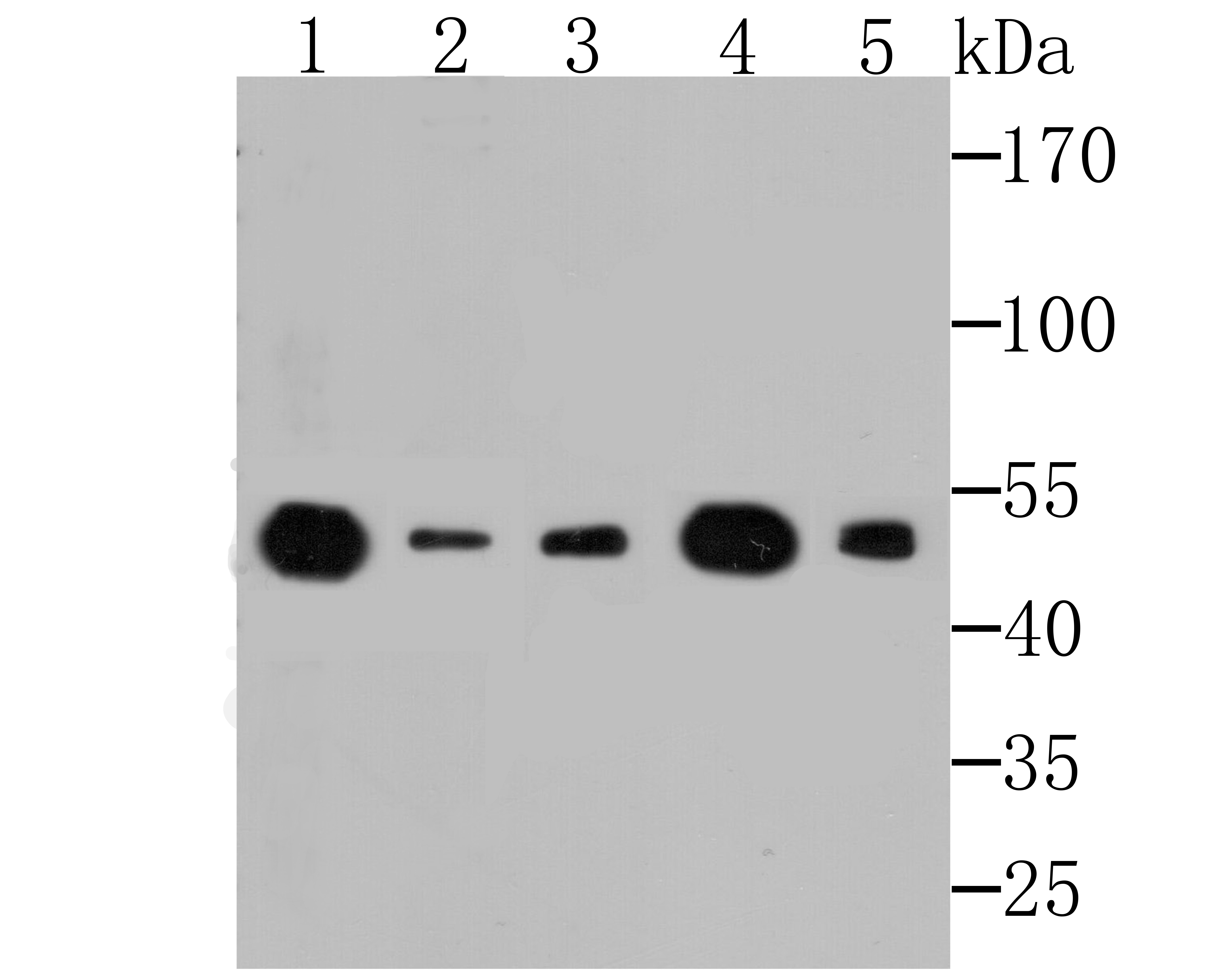 Lane 1: Rat brain tissue; Lane 2: Mouse skeletal muscle; Lane 3: Mouse cerebellum; Lane 4: Rat skin; Lane 5: Daudi Cells; Probed with eEF1A1 (3F9) Monoclonal Antibody (bsm-54320R) at 1:500 overnight at 4°C followed by a conjugated secondary antibody for 60 minutes at 37°C. Lane 1: Rat brain tissue; Lane 2: Mouse skeletal muscle; Lane 3: Mouse cerebellum; Lane 4: Rat skin; Lane 5: Daudi Cells; Probed with eEF1A1 (3F9) Monoclonal Antibody (bsm-54320R) at 1:500 overnight at 4°C followed by a conjugated secondary antibody for 60 minutes at 37°C.