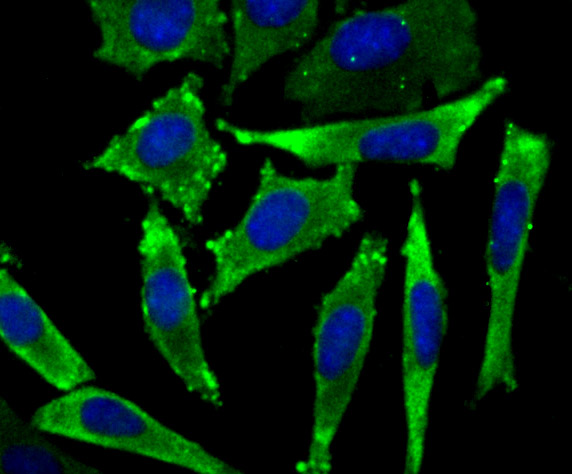 IF(ICC) staining with eEF1A1 (3F9) Monoclonal Antibody (bsm-54320R) at 1:100 in SH-SY5Y cells (green). The nuclear counterstain is DAPI (blue). Cells were fixed in paraformaldehyde, permeabilized with 0.25% Triton X100/PBS.
