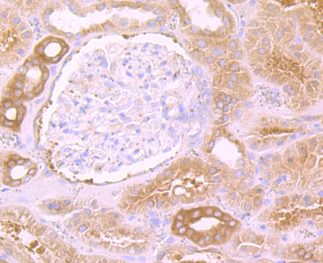 Paraformaldehyde-fixed and paraffin-embedded Human Kidney tissue incubated eEF1A1 (3F9) Monoclonal Antibody (bsm-54320R) at 1:100, overnight at 4°C, followed by a conjugated secondary antibody and DAB staining. Counterstained with hematoxylin.