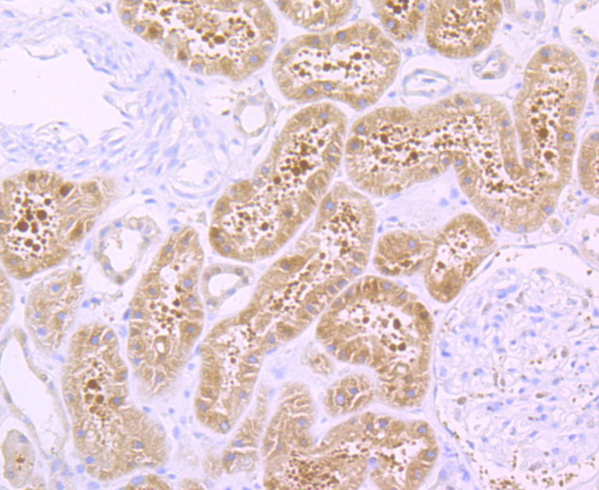 Paraformaldehyde-fixed and paraffin-embedded Human Kidney tissue incubated with CDH13 (6F11) Monoclonal Antibody (bsm-54321R) at 1:100, overnight at 4°C, followed by a conjugated secondary antibody and DAB staining. Counterstained with hematoxylin.