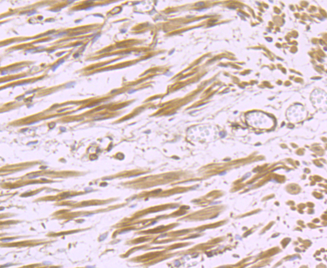 Paraformaldehyde-fixed and paraffin-embedded Human Fetal Skeletal Muscle tissue incubated with CDH13 (6F11) Monoclonal Antibody (bsm-54321R) at 1:100, overnight at 4°C, followed by a conjugated secondary antibody and DAB staining. Counterstained with hematoxylin.