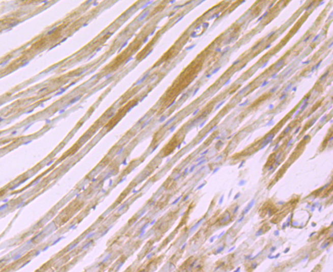 Paraformaldehyde-fixed and paraffin-embedded Mouse Heart tissue incubated with CDH13 (6F11) Monoclonal Antibody (bsm-54321R) at 1:100, overnight at 4°C, followed by a conjugated secondary antibody and DAB staining. Counterstained with hematoxylin.