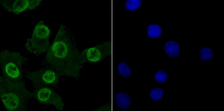 IF(ICC) staining with MBD3 (6B10) Monoclonal Antibody (bsm-54322R) at 1:100 in A549 cells (green). The nuclear counterstain is DAPI (blue). Cells were fixed in paraformaldehyde, permeabilized with 0.25% Triton X100/PBS.