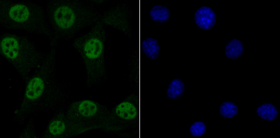IF(ICC) staining with MBD3 (6B10) Monoclonal Antibody (bsm-54322R) at 1:100 in NIH-3T3 cells (green). The nuclear counterstain is DAPI (blue). Cells were fixed in paraformaldehyde, permeabilized with 0.25% Triton X100/PBS.