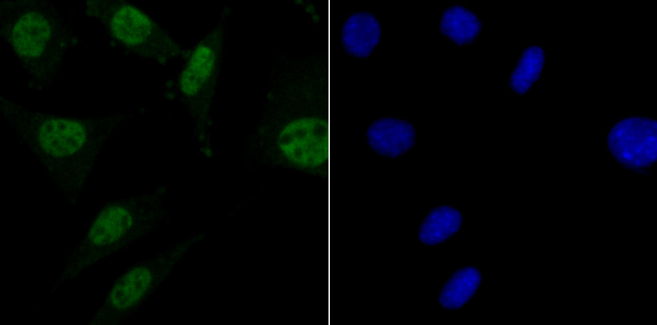 IF(ICC) staining with MBD3 (6B10) Monoclonal Antibody (bsm-54322R) at 1:100 in SH-SY5Y cells (green). The nuclear counterstain is DAPI (blue). Cells were fixed in paraformaldehyde, permeabilized with 0.25% Triton X100/PBS.