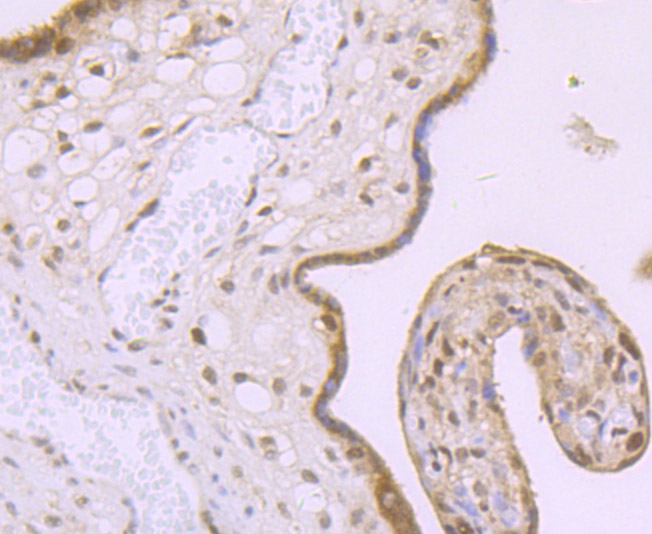 Paraformaldehyde-fixed and paraffin-embedded Human Placenta tissue incubated with MBD3 (6B10) Monoclonal Antibody (bsm-54322R) at 1:100, overnight at 4°C, followed by a conjugated secondary antibody and DAB staining. Counterstained with hematoxylin.