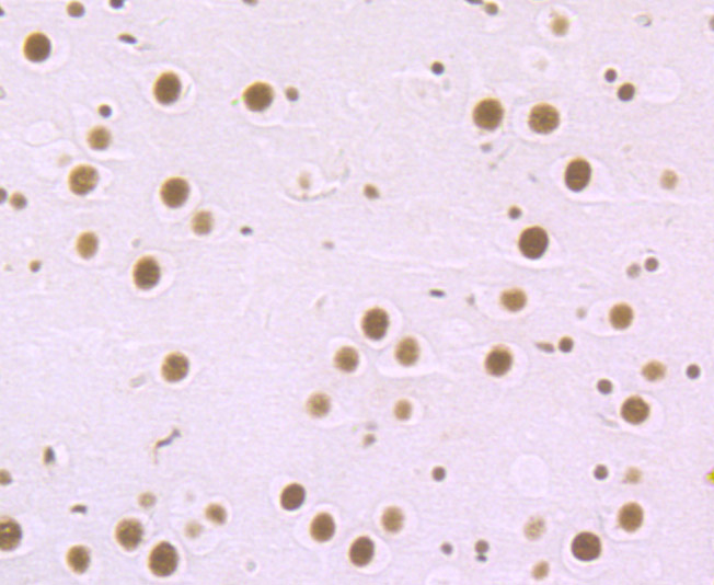 Paraformaldehyde-fixed and paraffin-embedded Mouse Brain tissue incubated with MBD3 (6B10) Monoclonal Antibody (bsm-54322R) at 1:100, overnight at 4°C, followed by a conjugated secondary antibody and DAB staining. Counterstained with hematoxylin.