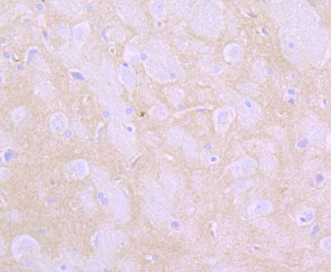Paraformaldehyde-fixed and paraffin-embedded Rat Brain tissue incubated with Flotillin 1 (4C3) Monoclonal Antibody (bsm-54325R) at 1:100, overnight at 4°C, followed by a conjugated secondary antibody and DAB staining. Counterstained with hematoxylin.