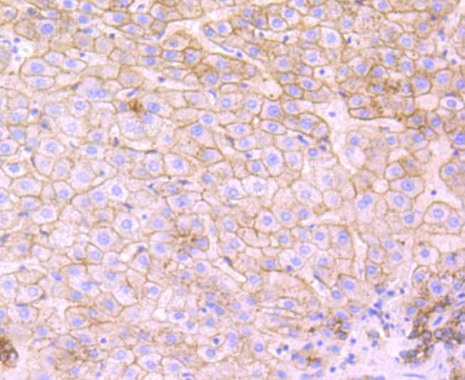 Paraformaldehyde-fixed and paraffin-embedded Human Liver tissue incubated with Flotillin 1 (4C3) Monoclonal Antibody (bsm-54325R) at 1:100, overnight at 4°C, followed by a conjugated secondary antibody and DAB staining. Counterstained with hematoxylin.