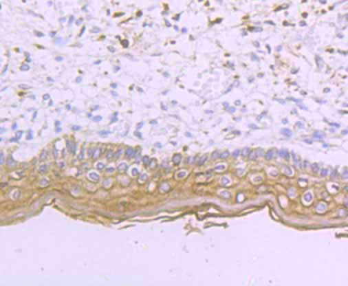 Paraformaldehyde-fixed and paraffin-embedded Human Skin tissue incubated with Desmoglein-1 (5C11) Monoclonal Antibody (bsm-54326R) at 1:100, overnight at 4°C, followed by a conjugated secondary antibody and DAB staining. Counterstained with hematoxylin.