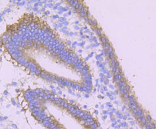 Paraformaldehyde-fixed and paraffin-embedded Human Uterus tissue incubated with Desmoglein-1 (5C11) Monoclonal Antibody (bsm-54326R) at 1:100, overnight at 4°C, followed by a conjugated secondary antibody and DAB staining. Counterstained with hematoxylin.