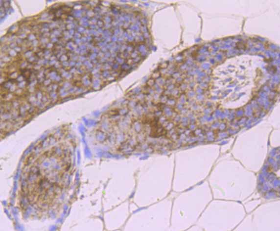 Paraformaldehyde-fixed and paraffin-embedded Mouse Skin tissue incubated with Desmoglein-1 (5C11) Monoclonal Antibody (bsm-54326R) at 1:100, overnight at 4°C, followed by a conjugated secondary antibody and DAB staining. Counterstained with hematoxylin.