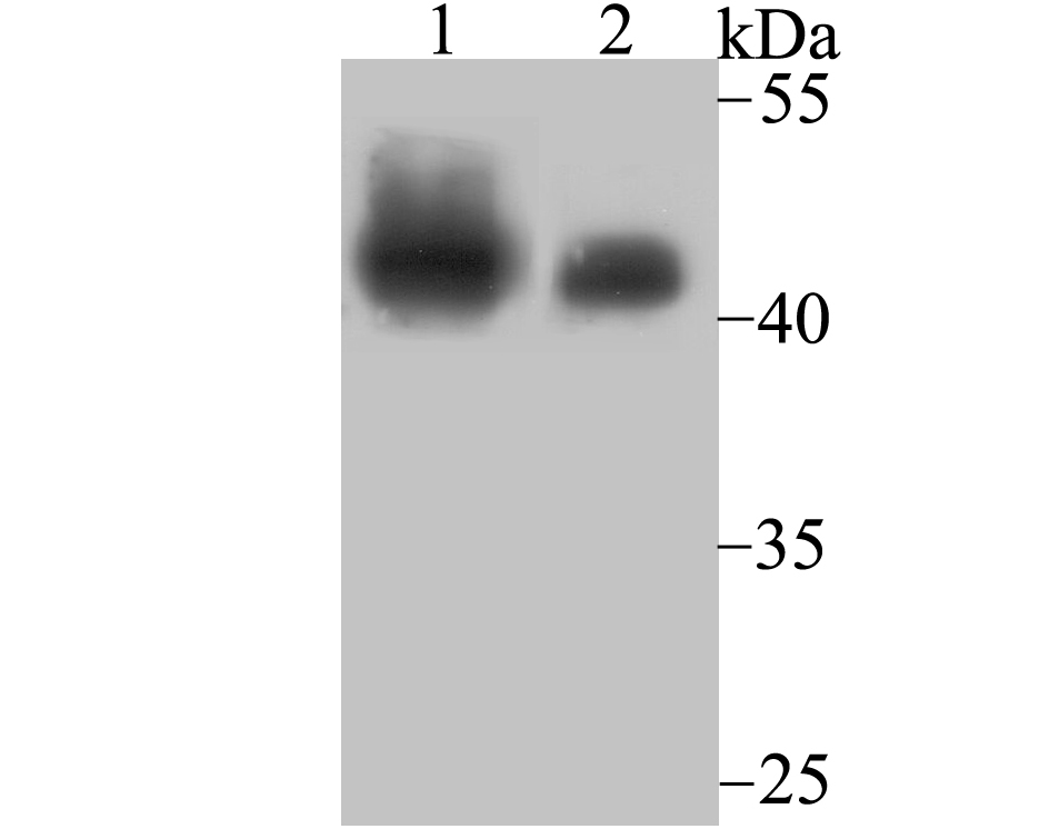 Lane 1: Daudi Cells; Lane 2: Mouse Lymph Node; Probed with SMARCB1 (7G8) Monoclonal Antibody (bsm-54327R) at 1:500 overnight at 4°C followed by a conjugated secondary antibody for 60 minutes at 37°C. Lane 1: Daudi Cells; Lane 2: Mouse Lymph Node; Probed with SMARCB1 (7G8) Monoclonal Antibody (bsm-54327R) at 1:500 overnight at 4°C followed by a conjugated secondary antibody for 60 minutes at 37°C.