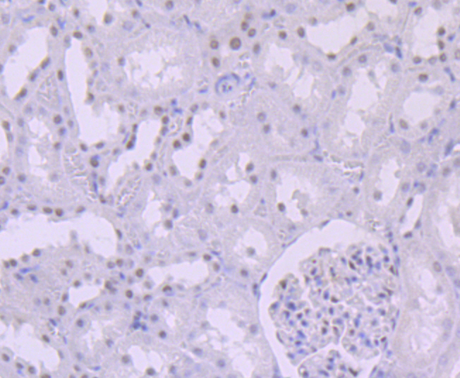 Paraformaldehyde-fixed and paraffin-embedded Rat Kidney tissue incubated with SMARCB1 (7G8) Monoclonal Antibody (bsm-54327R) at 1:100, overnight at 4°C, followed by a conjugated secondary antibody and DAB staining. Counterstained with hematoxylin.