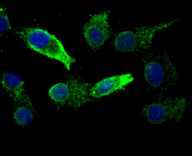 IF(ICC) staining with KDELR1 (3A6) Monoclonal Antibody (bsm-54328R) at 1:100 in A549 cells (green). The nuclear counterstain is DAPI (blue). Cells were fixed in paraformaldehyde, permeabilized with 0.25% Triton X100/PBS.