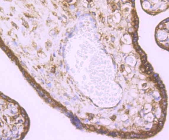 Paraformaldehyde-fixed and paraffin-embedded Human Placenta tissue incubated with KDELR1 (3A6) Monoclonal Antibody (bsm-54328R) at 1:200, overnight at 4°C, followed by a conjugated secondary antibody and DAB staining. Counterstained with hematoxylin.