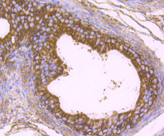 Paraformaldehyde-fixed and paraffin-embedded Rat Epididymis tissue incubated with KDELR1 (3A6) Monoclonal Antibody (bsm-54328R) at 1:100, overnight at 4°C, followed by a conjugated secondary antibody and DAB staining. Counterstained with hematoxylin.
