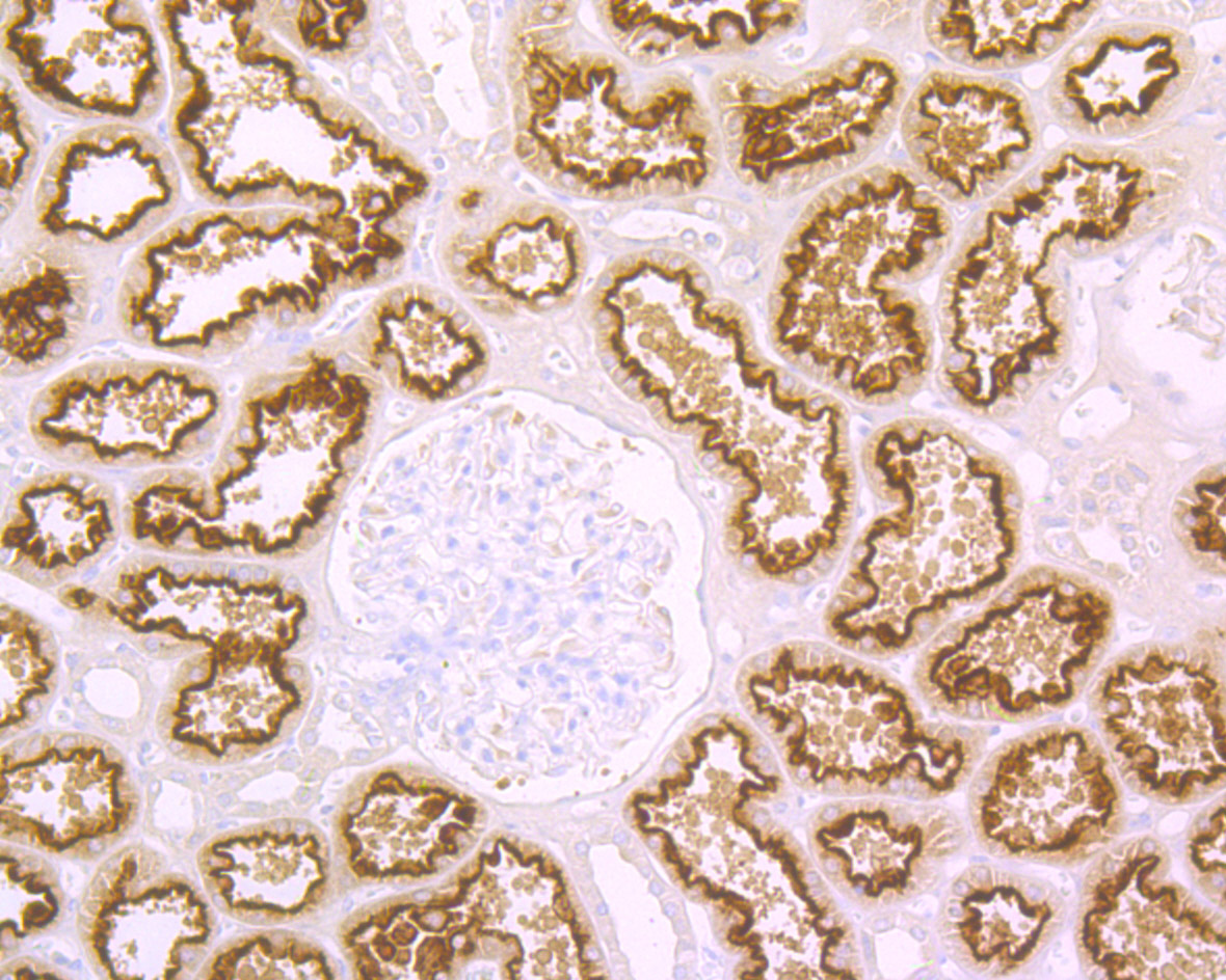 Paraformaldehyde-fixed and paraffin-embedded Human Kidney tissue incubated with Cubilin (7B12) Monoclonal Antibody (bsm-54329R) at 1:100, overnight at 4°C, followed by a conjugated secondary antibody and DAB staining. Counterstained with hematoxylin.