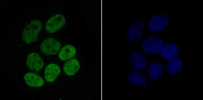 IF(ICC) staining with Histone H4 (acetyl K16) (2G2) Monoclonal Antibody (bsm-54330R) at 1:100 in Hela cells (green). The nuclear counterstain is DAPI (blue). Cells were fixed in paraformaldehyde, permeabilized with 0.25% Triton X100/PBS.