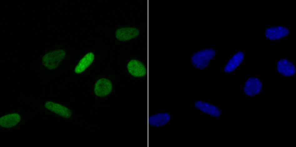 IF(ICC) staining with Histone H4 (acetyl K16) (2G2) Monoclonal Antibody (bsm-54330R) at 1:100 in SH-SY5Y cells (green). The nuclear counterstain is DAPI (blue). Cells were fixed in paraformaldehyde, permeabilized with 0.25% Triton X100/PBS.