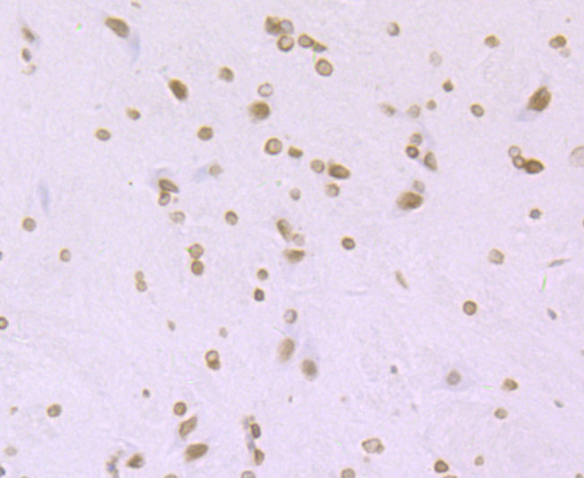 Paraformaldehyde-fixed and paraffin-embedded Rat Brain tissue incubated with Histone H4 (acetyl K16) (2G2) Monoclonal Antibody (bsm-54330R) at 1:100, overnight at 4°C, followed by a conjugated secondary antibody and DAB staining. Counterstained with hematoxylin.