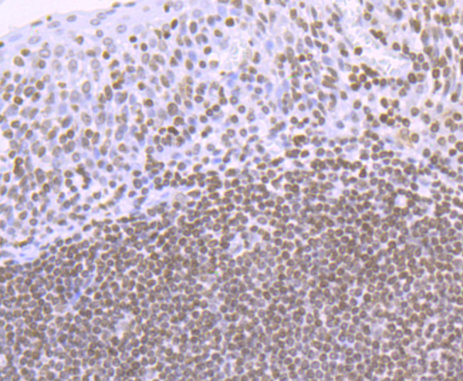 Paraformaldehyde-fixed and paraffin-embedded Human Tonsil tissue incubated with Histone H4 (acetyl K16) (2G2) Monoclonal Antibody (bsm-54330R) at 1:100, overnight at 4°C, followed by a conjugated secondary antibody and DAB staining. Counterstained with hematoxylin.