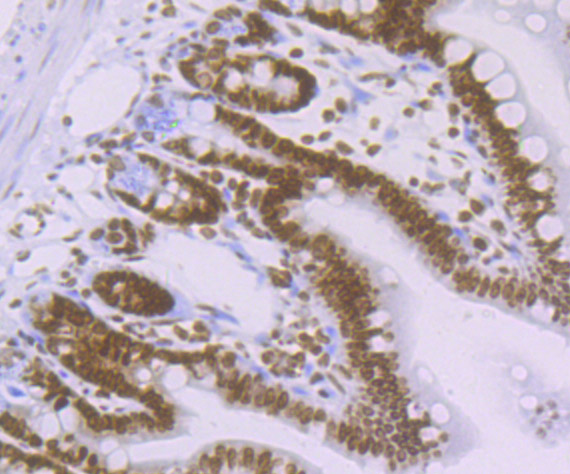 Paraformaldehyde-fixed and paraffin-embedded Mouse Colon tissue incubated with Histone H4 (acetyl K16) (2G2) Monoclonal Antibody (bsm-54330R) at 1:100, overnight at 4°C, followed by a conjugated secondary antibody and DAB staining. Counterstained with hematoxylin.