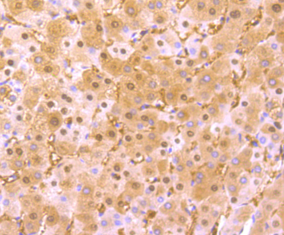 Paraformaldehyde-fixed and paraffin-embedded Human Liver tissue incubated with Arginase-1 (2C12) Monoclonal Antibody (bsm-54331R) at 1:100, overnight at 4°C, followed by a conjugated secondary antibody and DAB staining. Counterstained with hematoxylin.