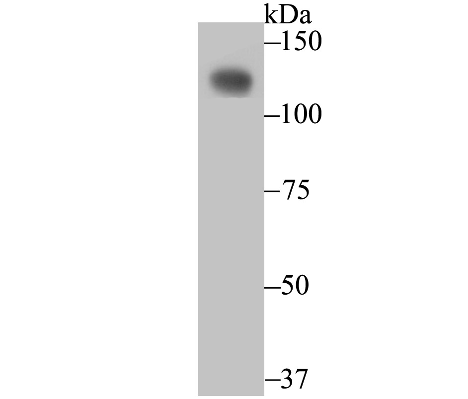 Lane 1: SiHa Cells; Probed with CD146 (1G3) Monoclonal Antibody (bsm-54332R) at 1:500 overnight at 4°C followed by a conjugated secondary antibody for 60 minutes at 37°C.