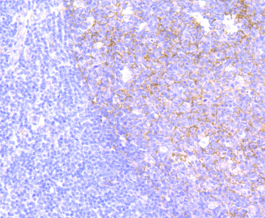 Paraformaldehyde-fixed and paraffin-embedded Human Tonsil tissue incubated with CD146 (1G3) Monoclonal Antibody (bsm-54332R) at 1:100, overnight at 4°C, followed by a conjugated secondary antibody and DAB staining. Counterstained with hematoxylin.