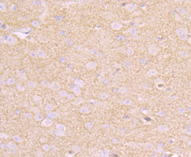 Paraformaldehyde-fixed and paraffin-embedded Mouse Brain tissue incubated with CD146 (1G3) Monoclonal Antibody (bsm-54332R) at 1:100, overnight at 4°C, followed by a conjugated secondary antibody and DAB staining. Counterstained with hematoxylin.