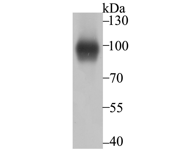 Lane 1: A431 Cells; Probed with Thrombomodulin (3G7) Monoclonal Antibody (bsm-54333R) at 1:500 overnight at 4°C followed by a conjugated secondary antibody for 60 minutes at 37°C.