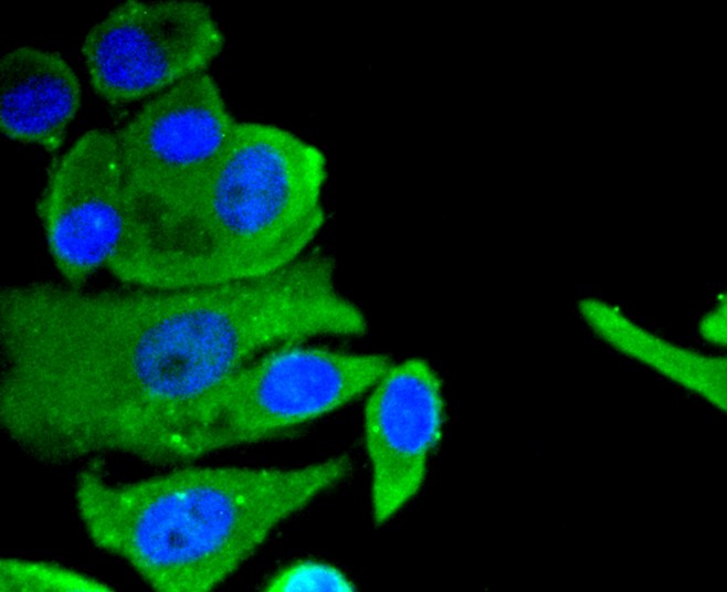 IF(ICC) staining with Neuropilin-1 (49H9) Monoclonal Antibody (bsm-52479R) at 1:100 in MCF-7 cells (green). The nuclear counterstain is DAPI (blue). Cells were fixed in paraformaldehyde, permeabilized with 0.25% Triton X100/PBS.