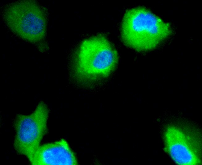 IF(ICC) staining with Neuropilin-1 (49H9) Monoclonal Antibody (bsm-52479R) at 1:100 in HUVEC cells (green). The nuclear counterstain is DAPI (blue). Cells were fixed in paraformaldehyde, permeabilized with 0.25% Triton X100/PBS.