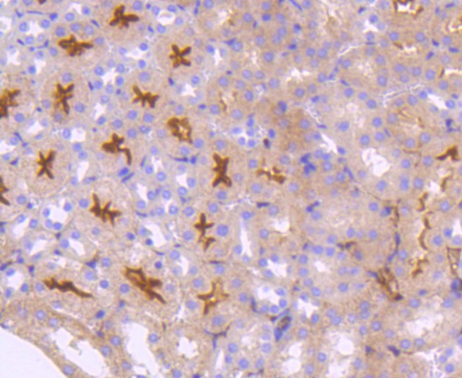 Paraformaldehyde-fixed and paraffin-embedded Mouse kidney tissue incubated with Neuropilin-1 (49H9) Monoclonal Antibody (bsm-52479R) at 1:100, overnight at 4°C, followed by a conjugated secondary antibody and DAB staining. Counterstained with hematoxylin.