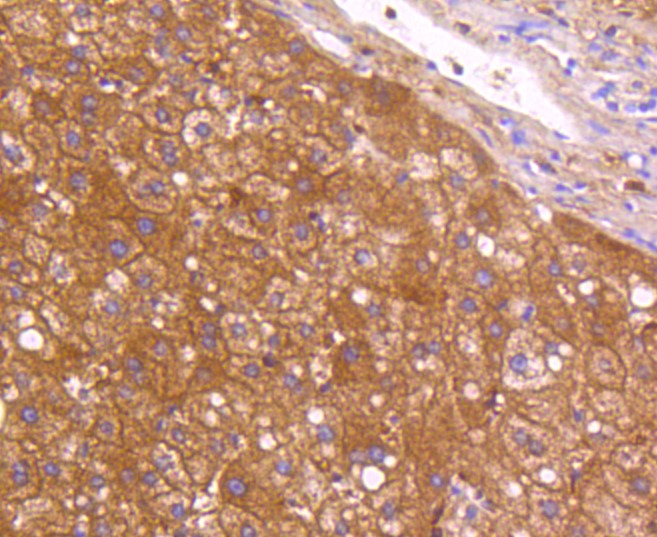 Paraformaldehyde-fixed and paraffin-embedded Human liver tissue incubated with Neuropilin-1 (49H9) Monoclonal Antibody (bsm-52479R) at 1:100, overnight at 4°C, followed by a conjugated secondary antibody and DAB staining. Counterstained with hematoxylin.