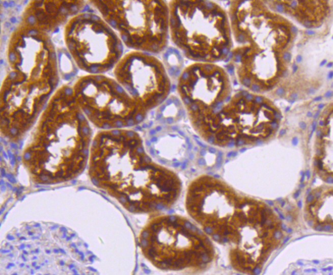Paraformaldehyde-fixed and paraffin-embedded Human kidney tissue incubated with Neuropilin-1 (49H9) Monoclonal Antibody (bsm-52479R) at 1:100, overnight at 4°C, followed by a conjugated secondary antibody and DAB staining. Counterstained with hematoxylin.
