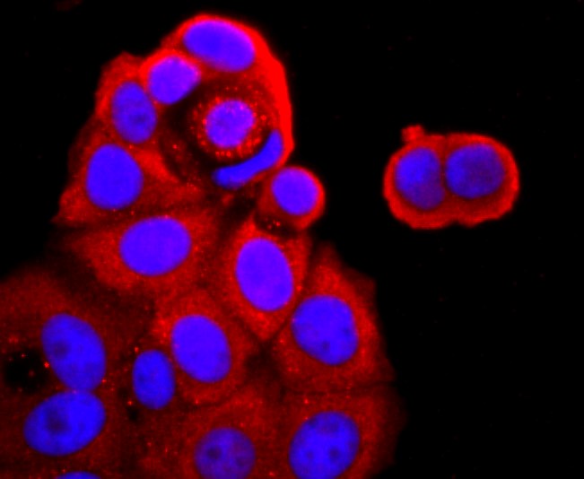 IF(ICC) staining with TNF Receptor II (7D3) Monoclonal Antibody (bsm-52938R) at 1:100 in MCF-7 cells (red). The nuclear counterstain is DAPI (blue). Cells were fixed in paraformaldehyde, permeabilized with 0.25% Triton X100/PBS.