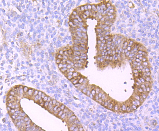 Paraformaldehyde-fixed and paraffin-embedded Human uterus tissue incubated with TNF Receptor II (7D3) Monoclonal Antibody (bsm-52938R) at 1:100, overnight at 4°C, followed by a conjugated secondary antibody and DAB staining. Counterstained with hematoxylin.